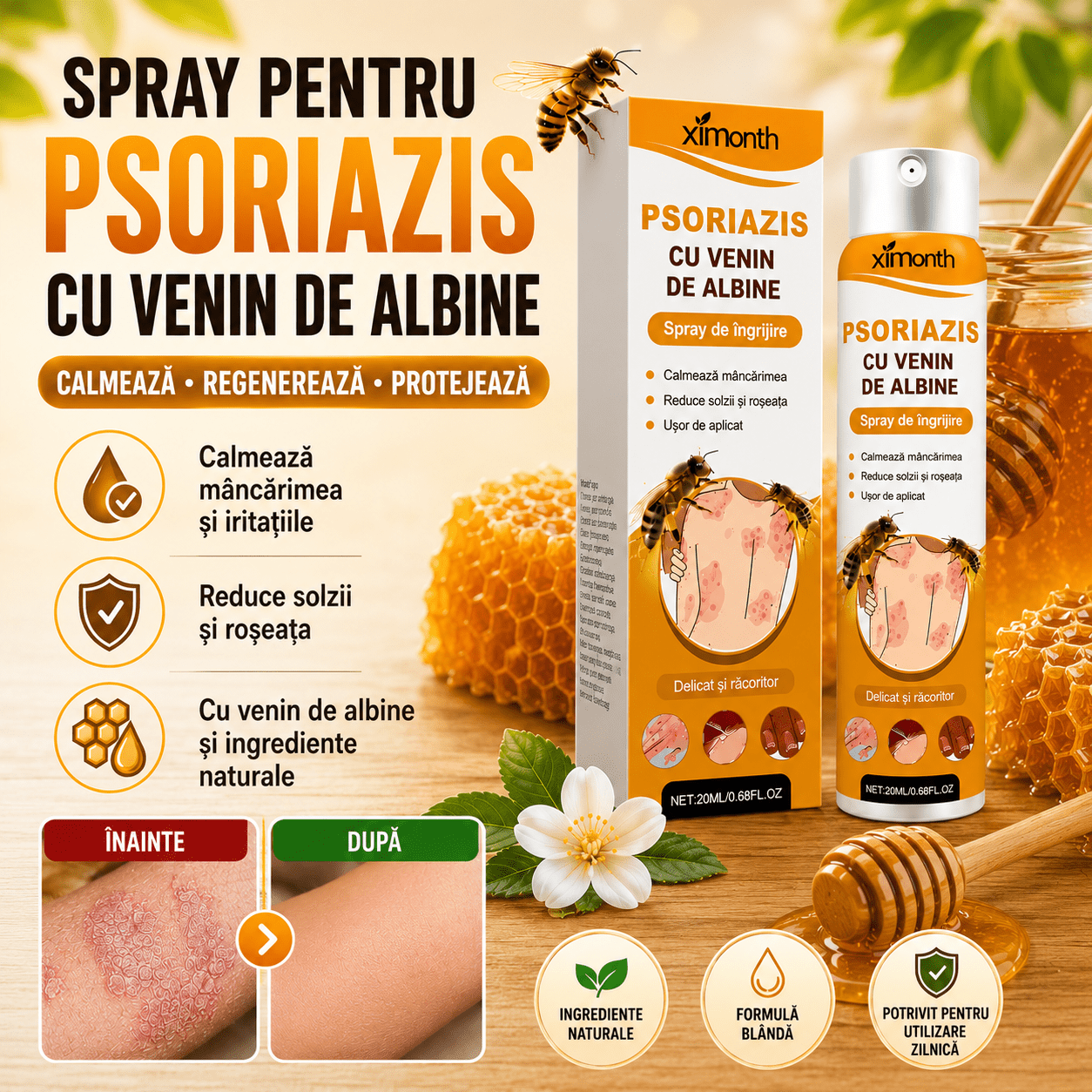 Spray de Psoriazis cu Venin de AlbineMain StoreMain StoreWYW-019Spray de Psoriazis cu Venin de Albine